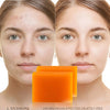 KOJIC ACID anti-depigmentation soap